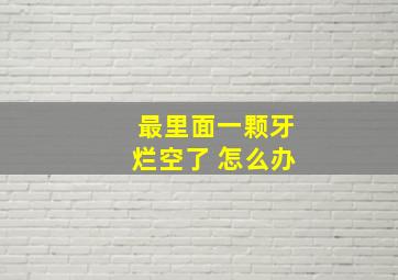 最里面一颗牙烂空了 怎么办